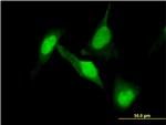 DPYSL2 Antibody in Immunocytochemistry (ICC/IF)