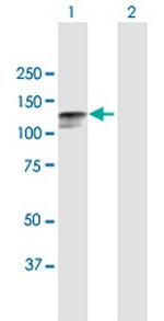 DSC2 Antibody in Western Blot (WB)