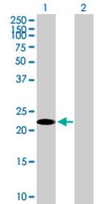 TSC22D3 Antibody in Western Blot (WB)