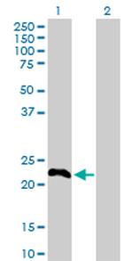 TSC22D3 Antibody in Western Blot (WB)