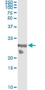 TSC22D3 Antibody in Immunoprecipitation (IP)