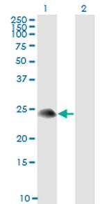 TSC22D3 Antibody in Western Blot (WB)