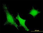 DUSP3 Antibody in Immunocytochemistry (ICC/IF)