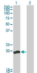 DUSP3 Antibody in Western Blot (WB)