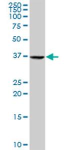 E2F4 Antibody in Western Blot (WB)