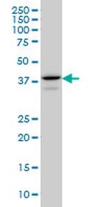 E2F4 Antibody in Western Blot (WB)