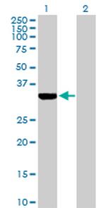 ECH1 Antibody in Western Blot (WB)