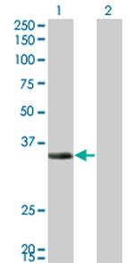 ECH1 Antibody in Western Blot (WB)