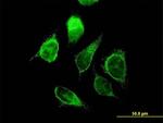 ECHS1 Antibody in Immunocytochemistry (ICC/IF)