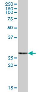 ECHS1 Antibody in Western Blot (WB)