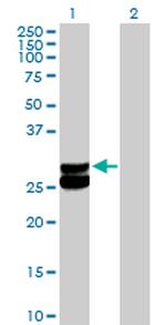 ECHS1 Antibody in Western Blot (WB)