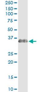 ECHS1 Antibody in Immunoprecipitation (IP)