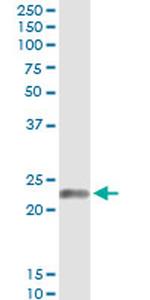 EDN1 Antibody in Immunoprecipitation (IP)