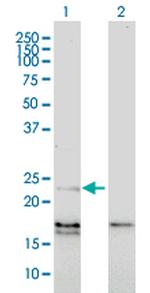 EDN1 Antibody in Western Blot (WB)