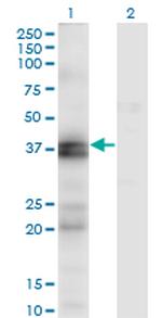 EDNRA Antibody in Western Blot (WB)