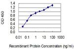 EDNRB Antibody in ELISA (ELISA)