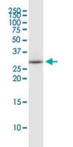 EEF1B2 Antibody in Western Blot (WB)