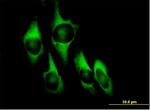 EEF1D Antibody in Immunocytochemistry (ICC/IF)