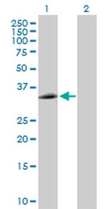 EEF1D Antibody in Western Blot (WB)