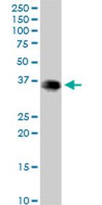 EEF1D Antibody in Western Blot (WB)