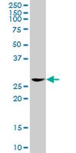 EEF1D Antibody in Western Blot (WB)