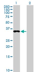 EEF1D Antibody in Western Blot (WB)