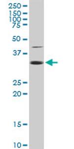 EEF1D Antibody in Western Blot (WB)