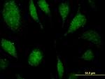 EEF1D Antibody in Immunocytochemistry (ICC/IF)