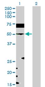 EEF1G Antibody in Western Blot (WB)