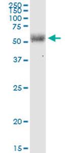 EIF2D Antibody in Western Blot (WB)