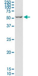 EIF2D Antibody in Western Blot (WB)