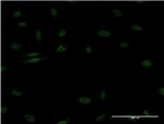 EGR1 Antibody in Immunocytochemistry (ICC/IF)