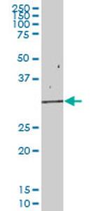 EIF2B1 Antibody in Western Blot (WB)