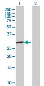 EIF2B1 Antibody in Western Blot (WB)