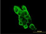 EPHA2 Antibody in Immunocytochemistry (ICC/IF)