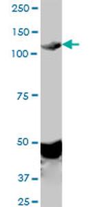 EPHA2 Antibody in Western Blot (WB)