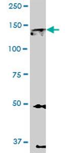 EPHA2 Antibody in Western Blot (WB)