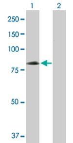 EIF4G1 Antibody in Western Blot (WB)