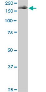 EIF4G1 Antibody in Western Blot (WB)