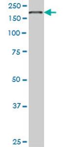 EIF4G1 Antibody in Western Blot (WB)