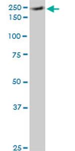 EIF4G1 Antibody in Western Blot (WB)