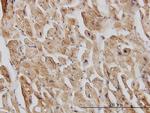 EIF4G2 Antibody in Immunohistochemistry (Paraffin) (IHC (P))