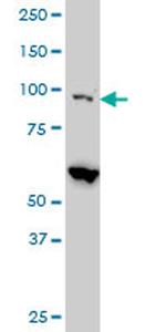 EIF4G2 Antibody in Western Blot (WB)