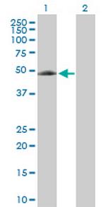 EIF5 Antibody in Western Blot (WB)