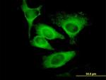 EIF5 Antibody in Immunocytochemistry (ICC/IF)