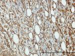 EIF5 Antibody in Immunohistochemistry (Paraffin) (IHC (P))