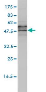 EIF5 Antibody in Western Blot (WB)