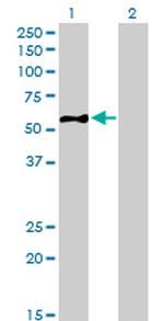 EIF5 Antibody in Western Blot (WB)