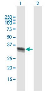 ELAVL4 Antibody in Western Blot (WB)