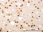 ELAVL4 Antibody in Immunohistochemistry (Paraffin) (IHC (P))